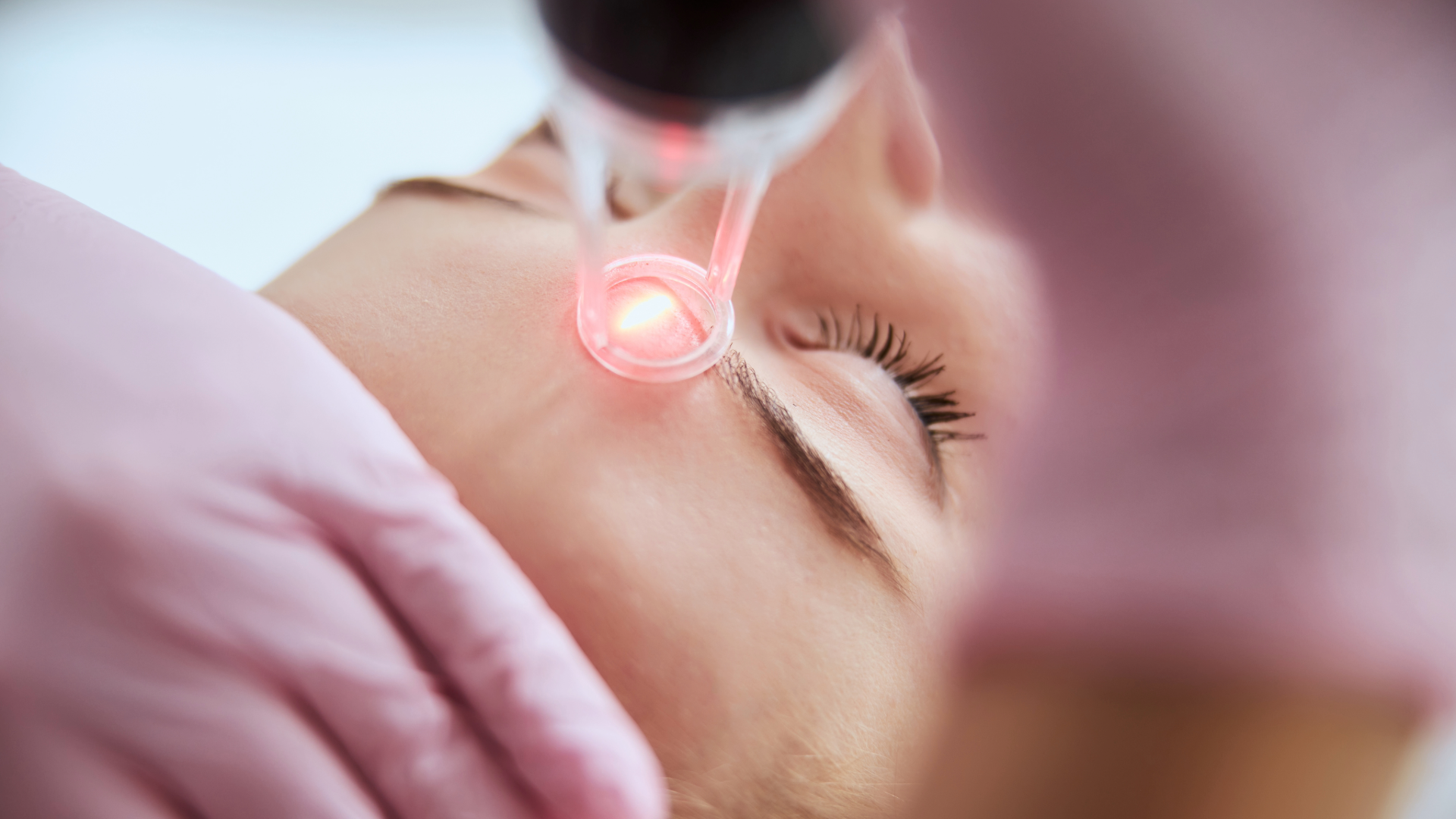 Laser Skin Resurfacing Techniques Sublative Radiofrequency Laser Skin Resurfacing Techniques